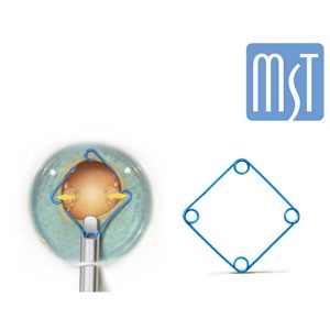 MST社　Malyuginリング